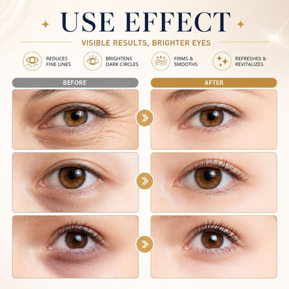 EyeDew™ Revitalizing Cream