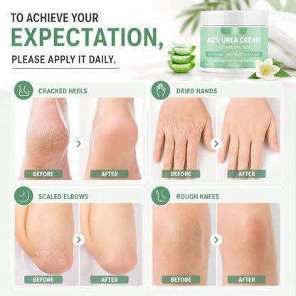 UreaSoft™ Moisture Cream